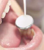 dental exam