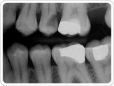 xray